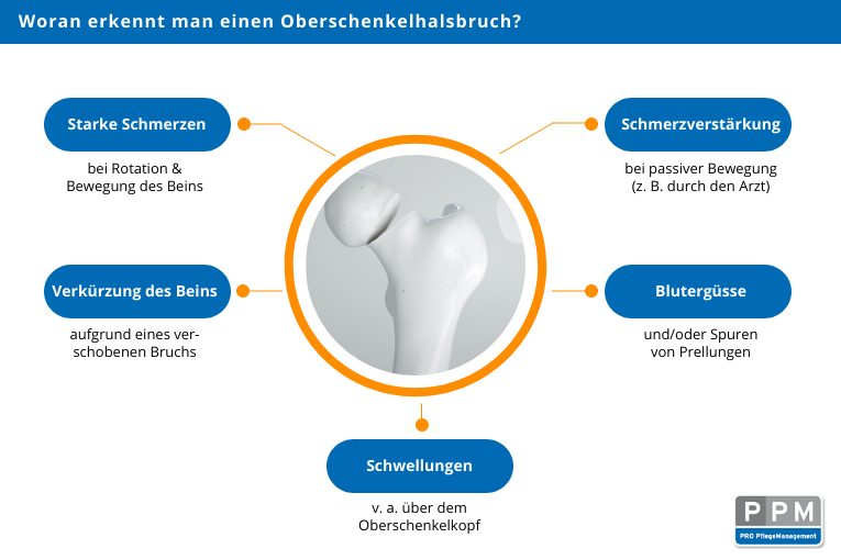 Infografik mit Informationen zu den Symptomen eines Oberschenkelhalsbruches.